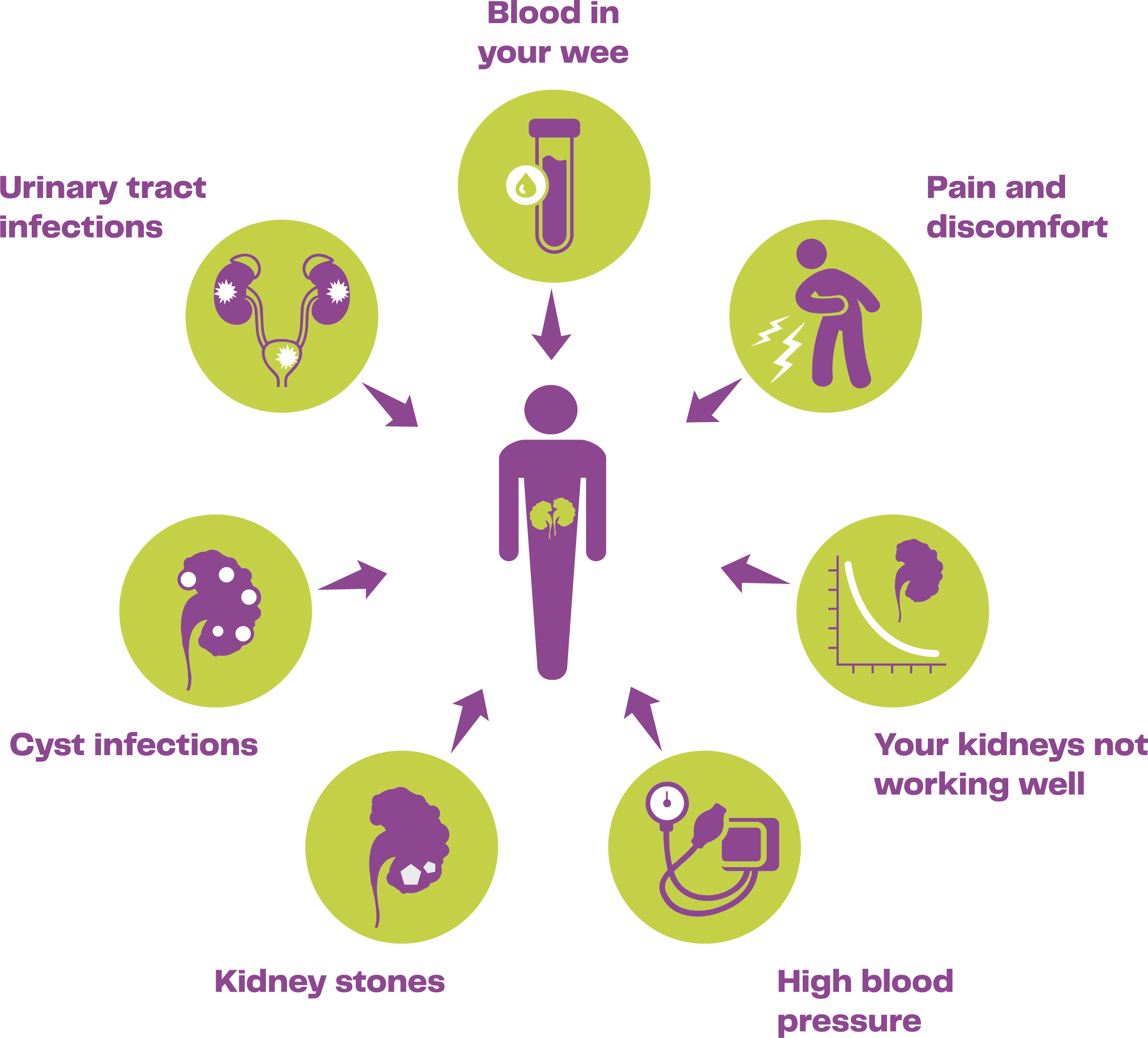 Diagram showing the more common symptoms of ADPKD: high blood pressure, urinary tract infections, cyst infections, blood in your wee, kidney stones, pain and discomfort, and your kidneys not working well.