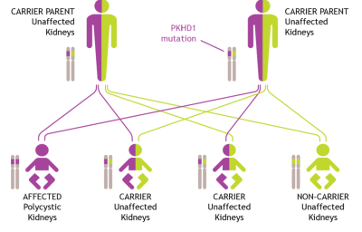 A diagram showing how ARPKD genes can be inherited, as we explain in the text above.